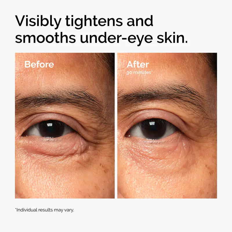 Targeted eye-area care for a smoother, firmer-looking appearance