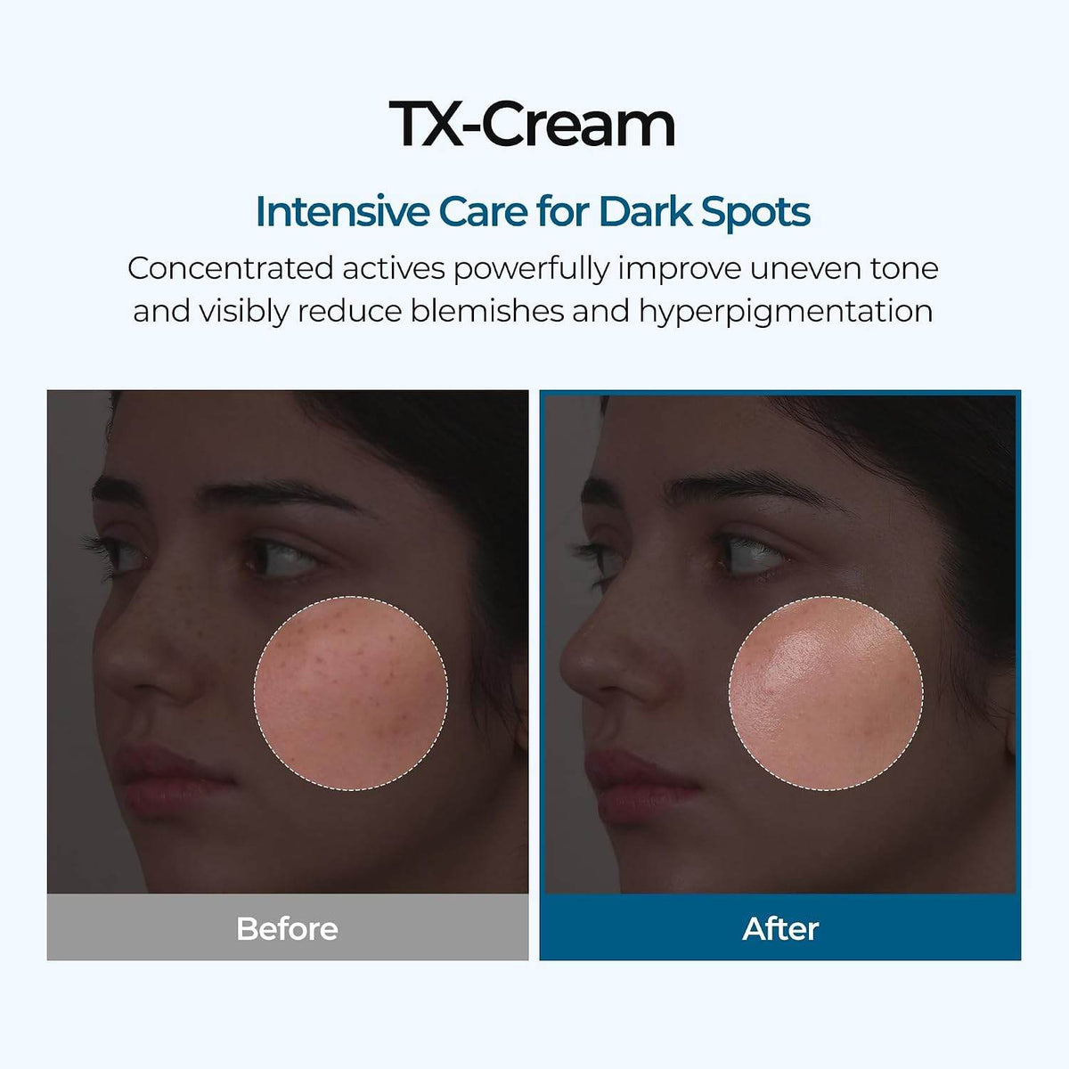 Advanced Dark Spot & Hyperpigmentation Fading Cream