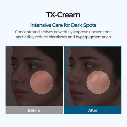 Advanced Dark Spot & Hyperpigmentation Fading Cream