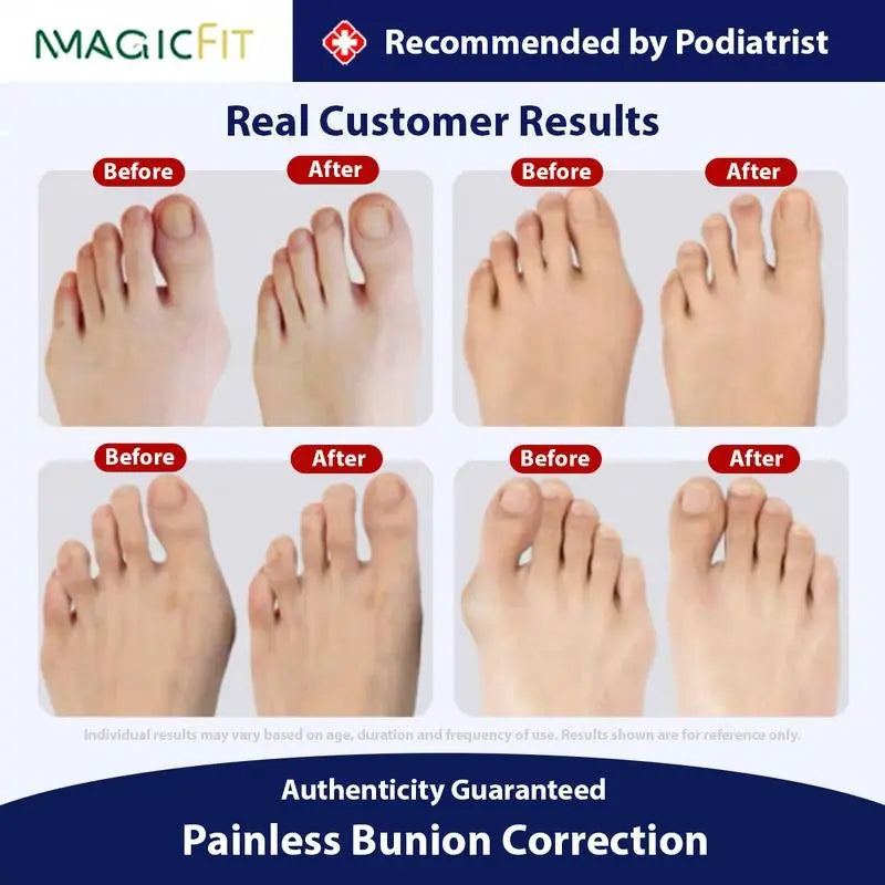 Relieve Bunion Pain & Align Toes Naturally – All-Day Comfort