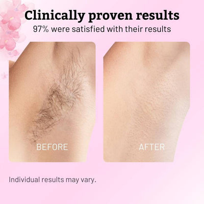 Natural Hair Growth Inhibitor Oil for Silky Smooth Skin