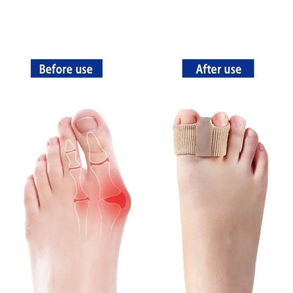 Relieve Bunion Pain & Align Toes Naturally – All-Day Comfort