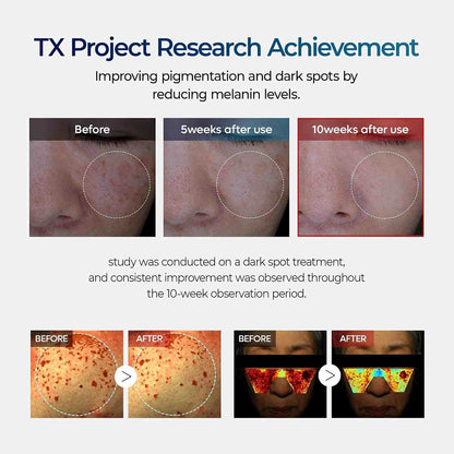 Advanced Dark Spot & Hyperpigmentation Fading Cream